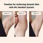 May-j™ – Full-Body Light Pulse Hair Remover